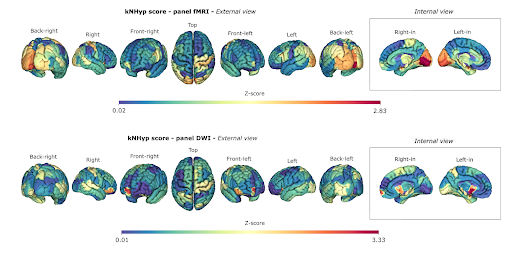 Physical Review E (@physreve) on Twitter photo Using hyperbolic embeddings of #BrainNetworks, scientists can identify regions of the brain affected by neurodegeneration in #Alzheimers, shedding light on connectivity patterns involved in #brain diseases. 🧠
Read the paper: go.aps.org/4iQdqL4
#neuroscience #physics Using hyperbolic embeddings of #BrainNetworks, scientists can identify regions of the brain affected by neurodegeneration in #Alzheimers, shedding light on connectivity patterns involved in #brain diseases. 🧠
Read the paper: go.aps.org/4iQdqL4
#neuroscience #physics