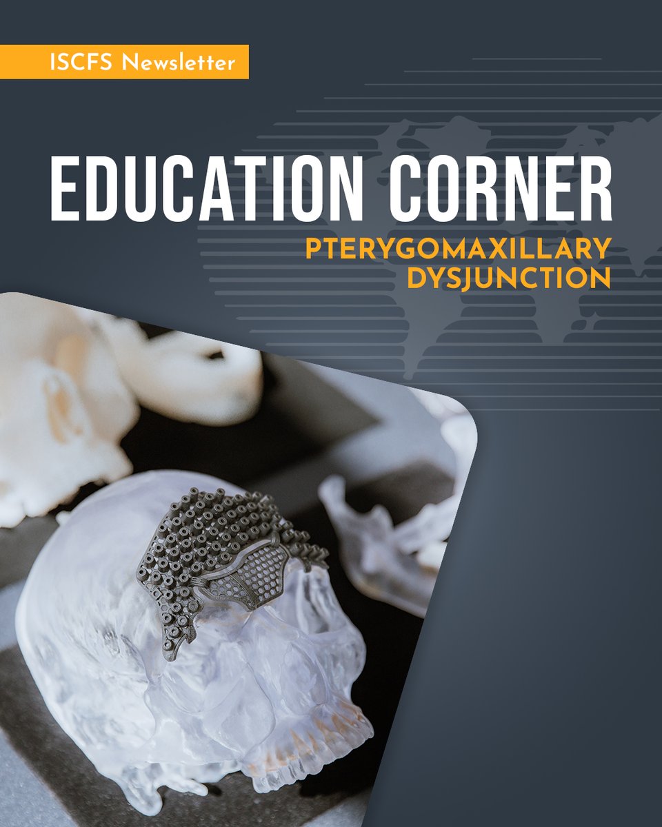 Dr. Richard Hopper’s preferred approach to the pterygomaxillary dysjunction emphasizes precision and patient safety, particularly for complex cases like Treacher Collins, Apert, and Pfeiffer syndromes. Detailed in the ISCFS Newsletter, Volume 1, Number 4. #CraniofacialSurgery