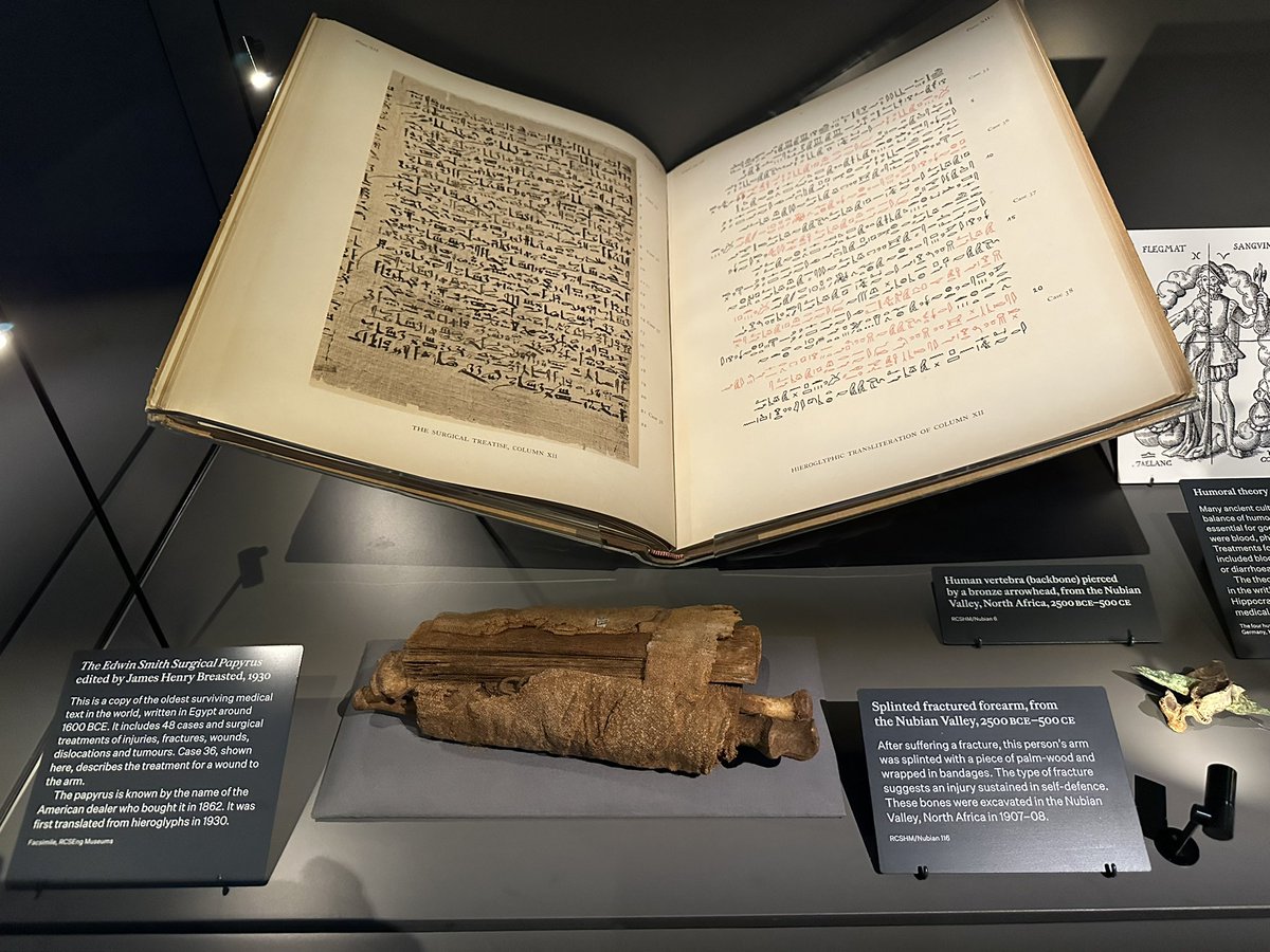 Hunter kanal derken Dr John Hunter’ın müzesine gitme fırsatım oldu. Müzede Edwin Smith Papirüsünü gördüm. Alt katta sadece cerrahların girebildiği kısımda fotoğraf çekmek yasaktı.
