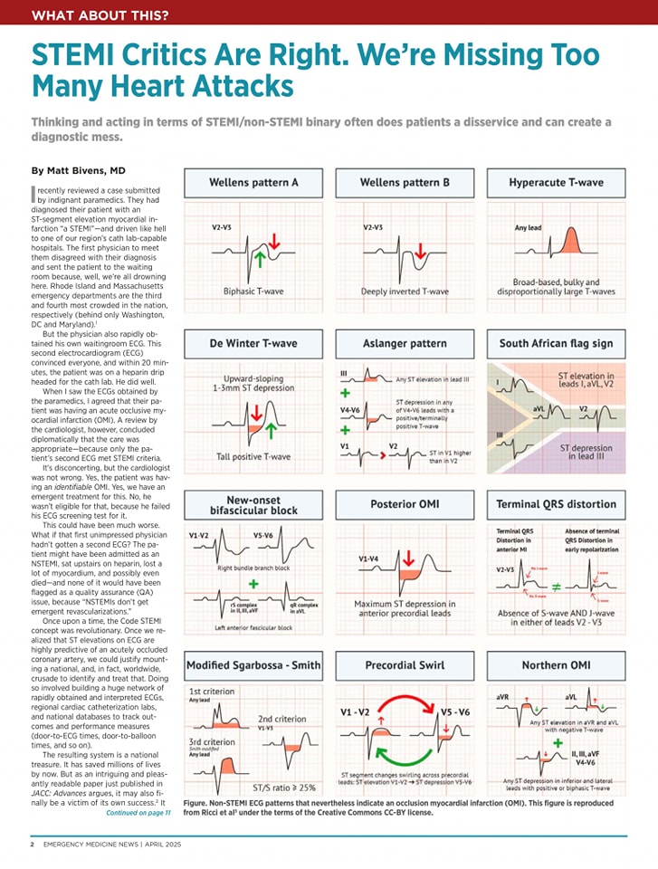🔴STEMI Critics Are Right. We're Missing Too Many Heart Attacks⤵️  #2025commentary #openaccess 

🔹journals.lww.com/em-news/fullte…  
#CardioEd #Cardiology #CardioX #MedEd #Cardiox #medx #Cardiology #ECG #ekg #EKGInterpretation  #Cardiotwitter #cardiotwiteros #medx #meded #medtwitter