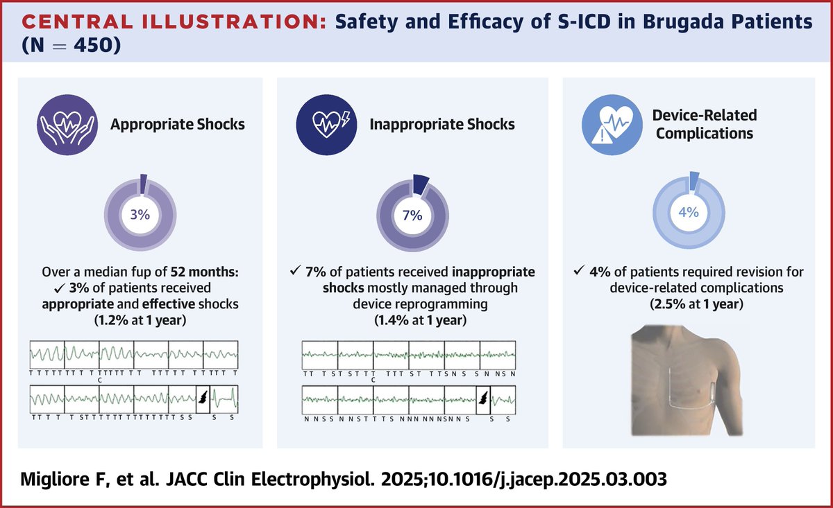 JACC Journals (@jaccjournals) on Twitter photo #EHRA2025 #JACCCEP LBCT: This multicenter study found that the S-ICD should be considered as a viable alternative to the transvenous #epICD for preventing sudden cardiac death in #Brugada syndrome patients without pacing indication jacc.org/doi/10.1016/j.… <a href="/Fede79Miglio/">Federico Migliore</a> #EHRA2025 #JACCCEP LBCT: This multicenter study found that the S-ICD should be considered as a viable alternative to the transvenous #epICD for preventing sudden cardiac death in #Brugada syndrome patients without pacing indication jacc.org/doi/10.1016/j.… <a href="/Fede79Miglio/">Federico Migliore</a>