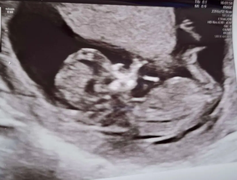 HamboWambo's tweet photo. The bearer of my seed swells with my firstborn... https://t.co/4N7TqgSE5O