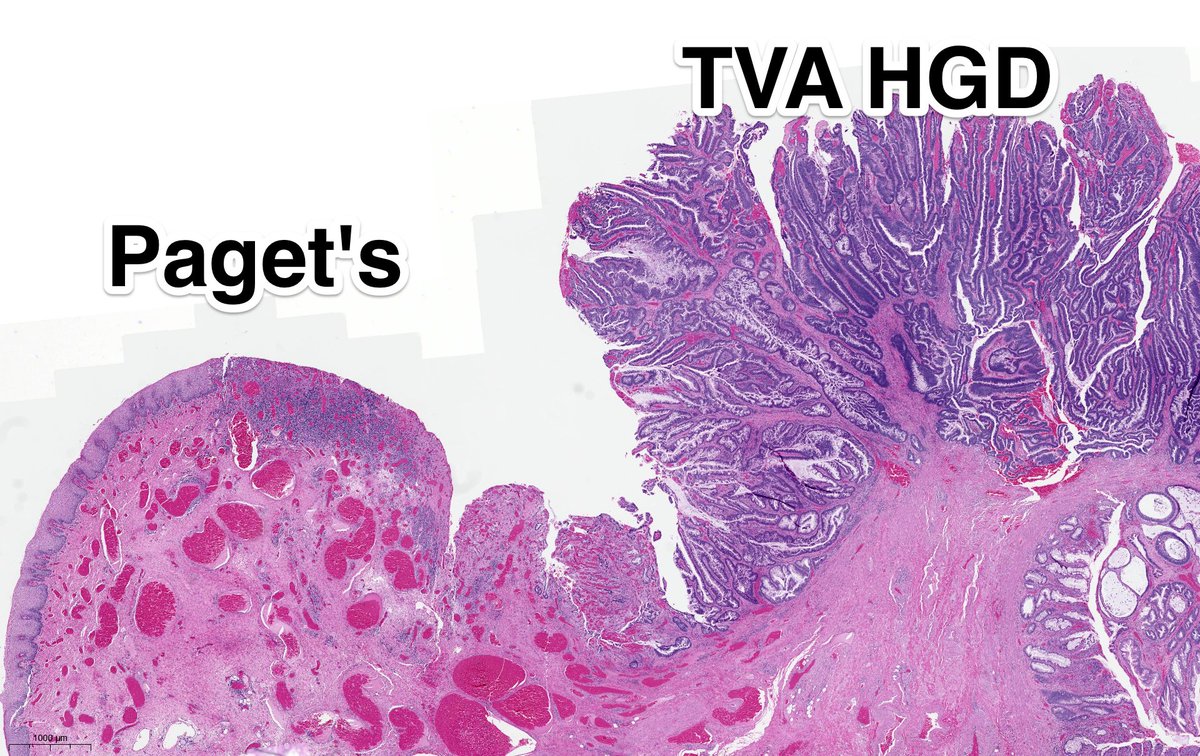 Tim Bracey tweet media