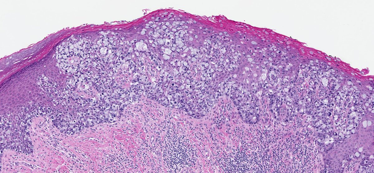 Tim Bracey tweet media