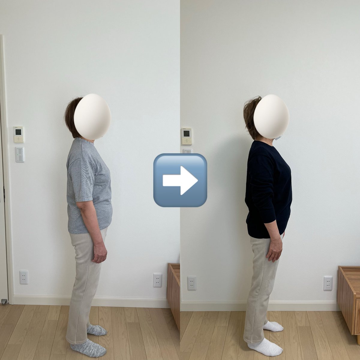 sachan0114's tweet photo. 【肩こり改善＆バストアップ効果！】

2回目の施術を受けに来てくれた
クライアントHさん。

前回より肩周りがスッキリし
肩こりや頭痛、膝痛の原因に
アプローチしました。

���腕の可動域も改善し
さらにバストアップ効果も実感！
筋肉を正しい位置に戻すことで
体のバランスが整います。

#姿勢矯正 https://t.co/SwMmT6ETyL