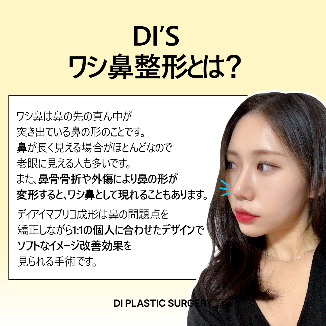 diprsjp's tweet photo. 🔥マブリコ成形で堂々とした自信を取り戻しましょう！ 🔥

✅コンプレックスを超えて美しさに！
鷲鼻は鼻の甲が飛び出して見えたり、非対称に見えたりすることがあります。 男性の方に劣らず、女性の方もむちがひどくて病院を訪れる方が多いですが、Diならではの経験をもとに、自然で調和のとれた鼻のラインを作ってあげます。

💡鷲鼻成形とは？
鷲鼻成形は鼻の甲の骨や軟骨を整え、平らでなめらかな鼻のラインを作る手術です。 特に顔のバランスを合わせて、より洗練された柔らかい印象を与えます。

🌟鷲鼻成形の必要性
鷲鼻は単純に外的な問題としてのみ考えられますが、個人の自信と心理的満足にも大きな影響を及ぼします。 特に鼻の甲の突出によって強い印象を与えたり、非対称によって顔の調和が崩れた場合、整形を通じて改善することができます。 また、鷲鼻を矯正することで、より柔らかく自然な印象を与えることができ、対人関係や職場生活でも肯定的な影響を及ぼすことがあります。

✨こんな方にオススメです:
-鼻面が突き出ていて印象が強く見える方
-鼻の甲の非対称でお悩みの方
-もっとおしゃれな鼻のラインが欲しい方

🏥当院のメブリコ整形特徴
🔍 精密分析: 個人別の鼻の形と顔の比率を徹底的に分析し、最適なデザインを提示します。
💼専門医療陣:豊富な経験を持つ整形外科専門医が直接執刀します。
🛡️安全な施術: 徹底した事前検査と安全システムで安心して施術を受けてください。
📈オーダーメイド型デザイン:個人の顔型と希望するイメージに合わせて、自然に調和した結果を生み出します。

 @574lbeop  https://t.co/YpKlZ5bLE2 

 #韓国整形外科 #韓国鼻整形 #韓国整形 #韓国鼻手術 #韓国整形情報 #韓国整形症例 #鼻整形症例 #韓国鼻整形症例 #鼻フル #団子鼻 #短い鼻 #自己肋軟骨 #鼻肋軟骨 #肋軟骨手術 #鼻手術 #鼻整形 #鼻再手術 #ハンプ手術 #ハンプ鼻 #ハンプ鼻手術 #鼻整形 #韓国鼻整形 #プロテーゼ #鼻中隔延長 #韓国鼻整形おすすめ #韓国整形外科おすすめ #韓国整形外科 #DI整形外科
