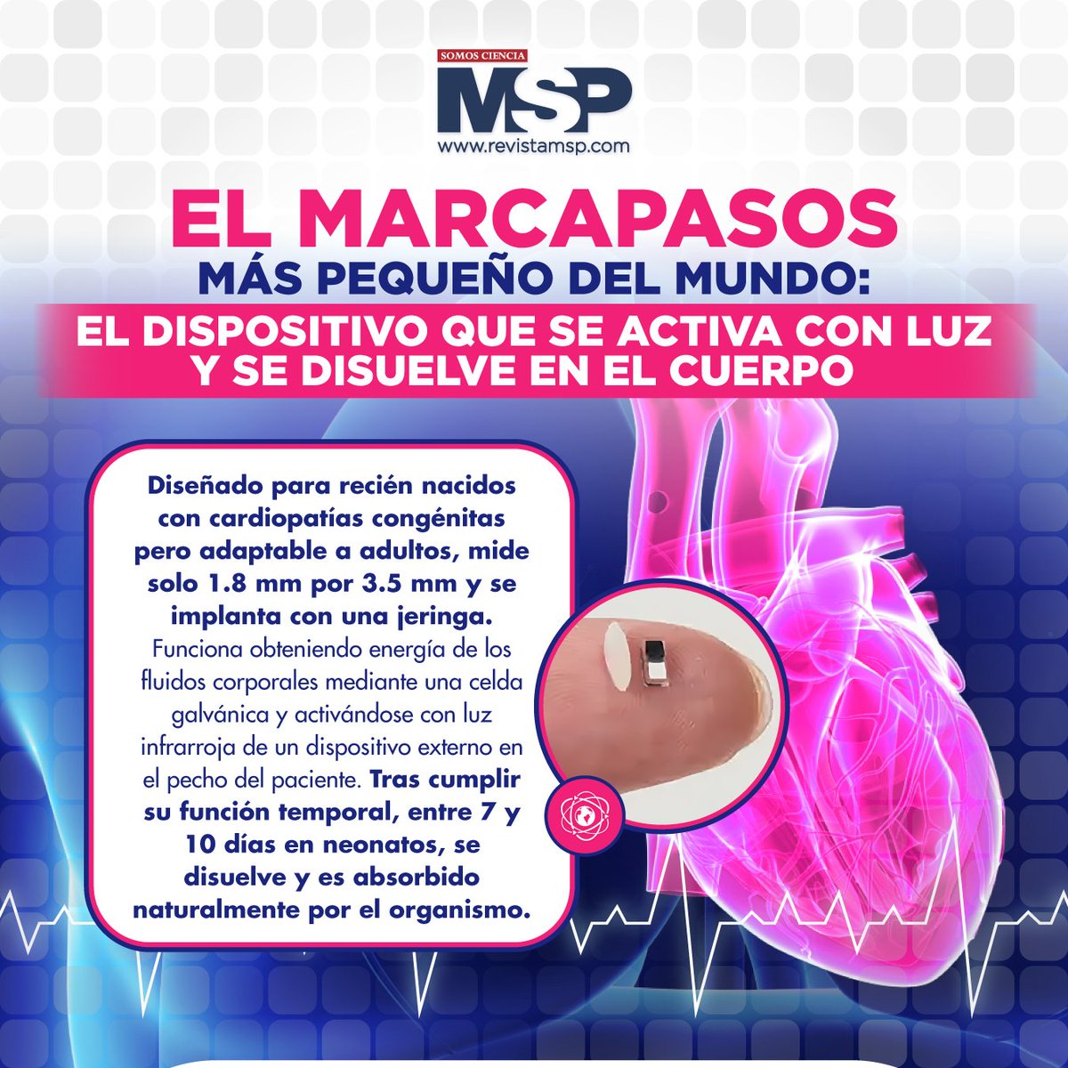 RevistaMSP's tweet image. #MSPCardiología 🫀 Descubre más sobre este marcapasos aquí: 
ow.ly/7YOb50VtCql

#MSP: El lugar donde médicos, profesionales de la salud y pacientes pueden entrar. #SomosCiencia

#MSPLíderesPioneros #MSPLegadoQueInspira