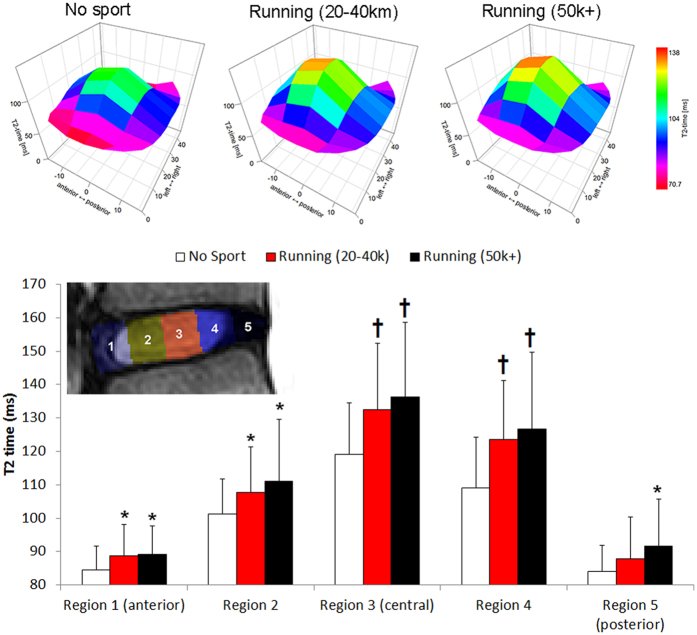 DavidMackeyDPT's tweet image. Long-distance runners &amp;amp; joggers may have healthier intervertebral discs with better hydration levels than the sedentary. In long-distance runners, IVDs had hypertrophy in lower segments (L3-S1) that are under higher stress during repetitive axial loading.
pmc.ncbi.nlm.nih.gov/articles/PMC53…