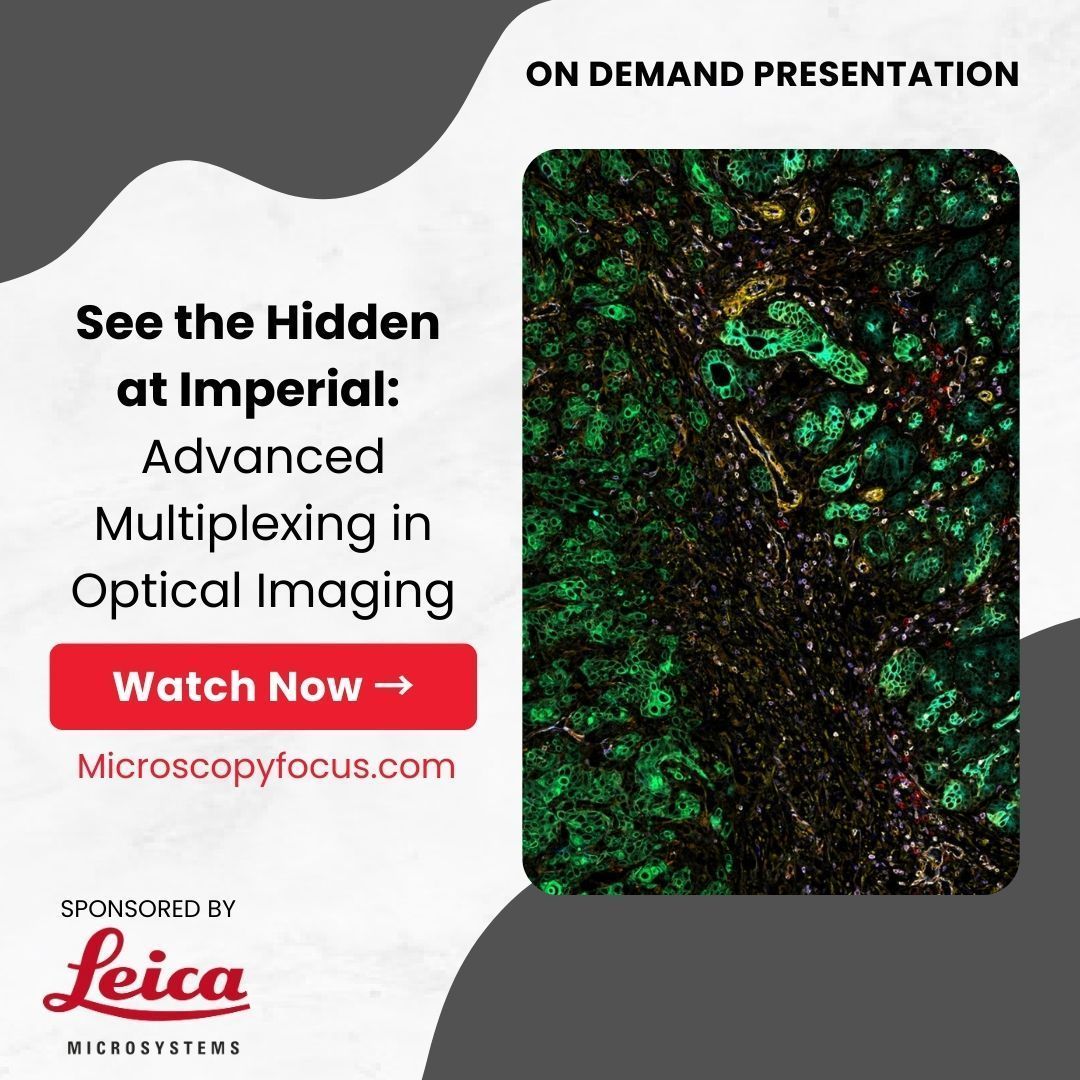 Bitesize Bio (@bitesizebio) on Twitter photo Join us and experts from <a href="/imperialcollege/">Imperial College London</a> to explore how the latest #multipleximaging approaches are providing new insights in biomedical research. Watch Now 👉 buff.ly/odY3ZPy with <a href="/LeicaMicro/">Leica Microsystems</a>. #microscopy #spatialbiology Join us and experts from <a href="/imperialcollege/">Imperial College London</a> to explore how the latest #multipleximaging approaches are providing new insights in biomedical research. Watch Now 👉 buff.ly/odY3ZPy with <a href="/LeicaMicro/">Leica Microsystems</a>. #microscopy #spatialbiology