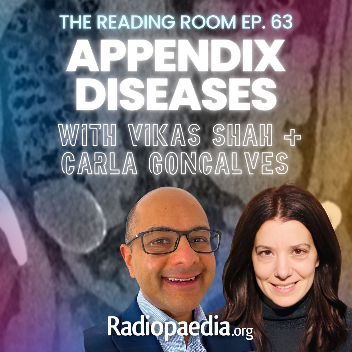 Andrew Dixon (@drandrewdixon) on Twitter photo New Radiopaedia Podcast episode! <a href="/DrVikasShah/">(𝚝𝚑𝚎𝚡𝚛𝚊𝚢𝚍𝚘𝚌𝚝𝚘𝚛)</a> chats with Carla Goncalves about appendicitis, appendiceal mucinous neoplasms, Fagan's nomogram, space and more!
Apple: podcasts.apple.com/us/podcast/the…
Spotify: open.spotify.com/show/6iQe9v7Tc…
YouTube: youtube.com/playlist?list=… New Radiopaedia Podcast episode! <a href="/DrVikasShah/">(𝚝𝚑𝚎𝚡𝚛𝚊𝚢𝚍𝚘𝚌𝚝𝚘𝚛)</a> chats with Carla Goncalves about appendicitis, appendiceal mucinous neoplasms, Fagan's nomogram, space and more!
Apple: podcasts.apple.com/us/podcast/the…
Spotify: open.spotify.com/show/6iQe9v7Tc…
YouTube: youtube.com/playlist?list=…