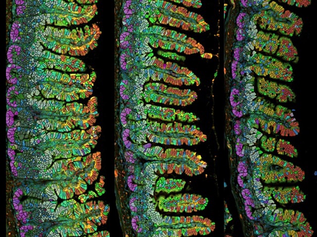 Biomedical Picture of the Day BPoD (@bpod_s) on Twitter photo Mother mouse intestine & its villi grow longer during pregnancy. Intestine elongation partially reverses & villi length fully reverts after lactation ceases
📷 Tomotsune Ameku, Anna Laddach & <a href="/hannahksb/">Hannah Beckwith</a> et al <a href="/FlyGutLab/">Irene Miguel-Aliaga</a> <a href="/TheCrick/">The Francis Crick Institute</a> in <a href="/CellCellPress/">Cell</a>
➡️ bpod.org.uk/archive/2025/4… Mother mouse intestine & its villi grow longer during pregnancy. Intestine elongation partially reverses & villi length fully reverts after lactation ceases
📷 Tomotsune Ameku, Anna Laddach & <a href="/hannahksb/">Hannah Beckwith</a> et al <a href="/FlyGutLab/">Irene Miguel-Aliaga</a> <a href="/TheCrick/">The Francis Crick Institute</a> in <a href="/CellCellPress/">Cell</a>
➡️ bpod.org.uk/archive/2025/4…