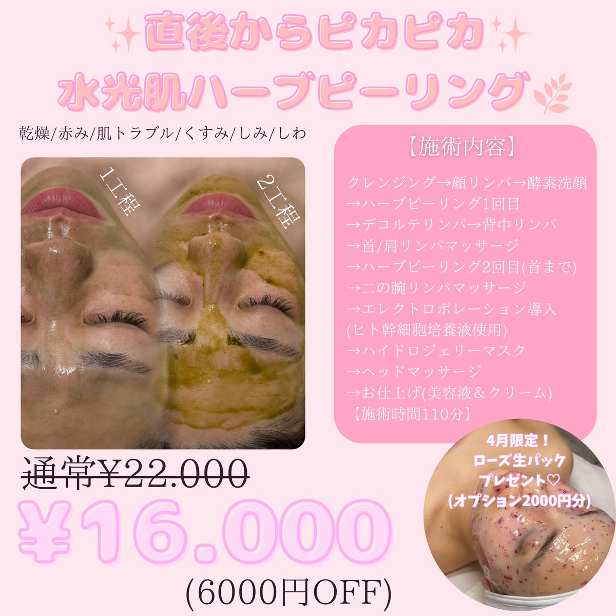 39_ceresol's tweet photo. 🌸4月限定スペシャルクーポン🌸
《小顔美人コルギ》
さくらカラー石膏パック＆
ヒト幹細胞導入付き
¥22.000→¥16.000
《ハーブピーリング✖︎リンパプラン》
ヒト幹細胞導入＆
ハイドロジェリーマスク付き
¥22.000→¥16.000
《毛穴洗浄プラン》
顔リンパ＆ハイドロジェリーマスク付
¥15.000→¥12.900 https://t.co/uBITsIf68W
