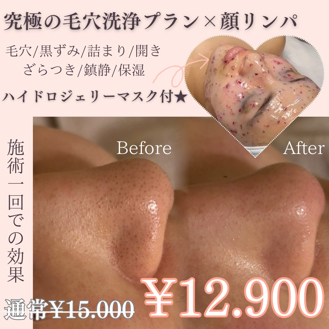 39_ceresol's tweet photo. 🌸4月限定スペシャルクーポン🌸
《小顔美人コルギ》
さくらカラー石膏パック＆
ヒト幹細胞導入付き
¥22.000→¥16.000
《ハーブピーリング✖︎リンパプラン》
ヒト幹細胞導入＆
ハイドロジェリーマスク付き
¥22.000→¥16.000
《毛穴洗浄プラン》
顔リンパ＆ハイドロジェリーマスク付
¥15.000→¥12.900 https://t.co/uBITsIf68W