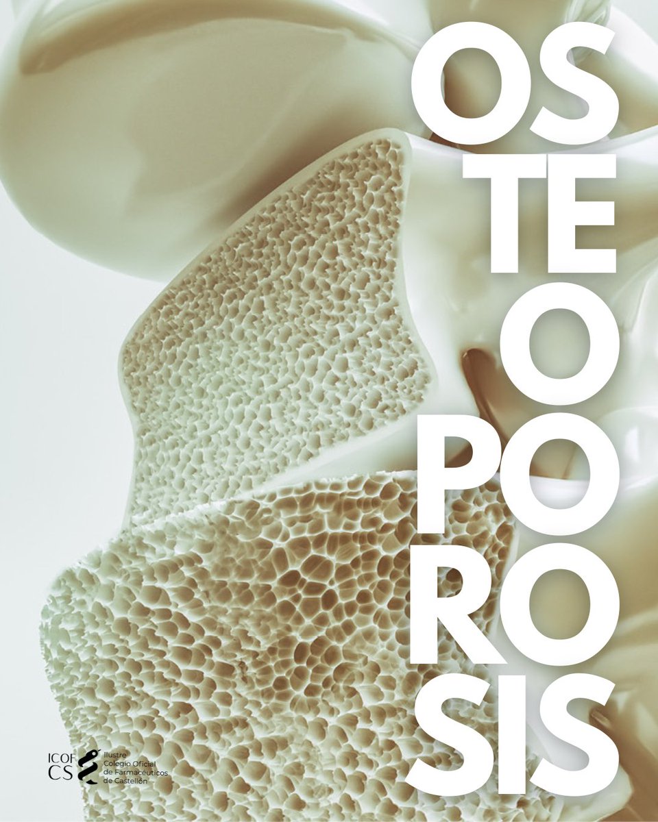 🦴#Osteoporosis es una enfermedad que debilita los huesos, aumentado el riesgo de fracturas. ¡Pero puedes prevenirla con buenos hábitos!

​👉🏼Dieta rica en calcio.
​👉🏼Exposición al sol y alimentos con vitamina D.
​👉🏼Evita tabaco y alcohol.
​👉🏼Ejercicio regular de impacto.

#ICOFCS