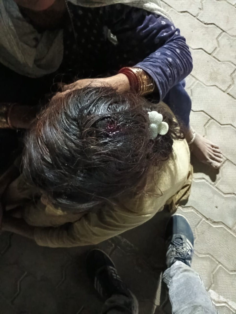 AnasSheik786's tweet photo. #लखनऊ
#थाना_माल क्षेत्र के एक गांव में जमीनी विवाद को लेकर एक पक्ष को दबंग पक्ष ने जमकर पीटा गंभीर रूप से बुजुर्ग लोग घायल थाने पर मौजूद @UPPViralCheck @Uppolice @LkoCp @LoJcp @dgpup @lkopolice @myogiadityanath @myogioffice @CMOfficeUP @DCPWEST1 @AdminLKO @homeupgov @UPGovt @ANI https://t.co/t6JEy1COOB