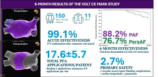 Europace Editor-in-Chief (@europaceeic) on Twitter photo ⚡️Highlights from #EHRA2025
🎈Safety and Effectiveness of the First Balloon-in-Basket #PFA System: VOLT CE Mark Study
📚doi.org/10.1093/europa…
<a href="/GiulioConte9/">Giulio Conte</a> <a href="/Dominik_Linz/">Dominik Linz</a> <a href="/FraSantoroMD/">Francesco Santoro, MD, PhD</a> <a href="/AndyZhangMD/">Xiaodong Zhang (Andy), MD, PhD, FHRS, FACC</a> <a href="/DavideMei93/">Davide Mei</a> <a href="/marcovitoloMD/">Marco Vitolo Ⓜ️</a> <a href="/LuigiDiBiaseMD/">Luigi Di Biase</a> <a href="/escardio/">European Society of Cardiology</a> <a href="/EHRAPresident/">EHRAPresident</a> ⚡️Highlights from #EHRA2025
🎈Safety and Effectiveness of the First Balloon-in-Basket #PFA System: VOLT CE Mark Study
📚doi.org/10.1093/europa…
<a href="/GiulioConte9/">Giulio Conte</a> <a href="/Dominik_Linz/">Dominik Linz</a> <a href="/FraSantoroMD/">Francesco Santoro, MD, PhD</a> <a href="/AndyZhangMD/">Xiaodong Zhang (Andy), MD, PhD, FHRS, FACC</a> <a href="/DavideMei93/">Davide Mei</a> <a href="/marcovitoloMD/">Marco Vitolo Ⓜ️</a> <a href="/LuigiDiBiaseMD/">Luigi Di Biase</a> <a href="/escardio/">European Society of Cardiology</a> <a href="/EHRAPresident/">EHRAPresident</a>