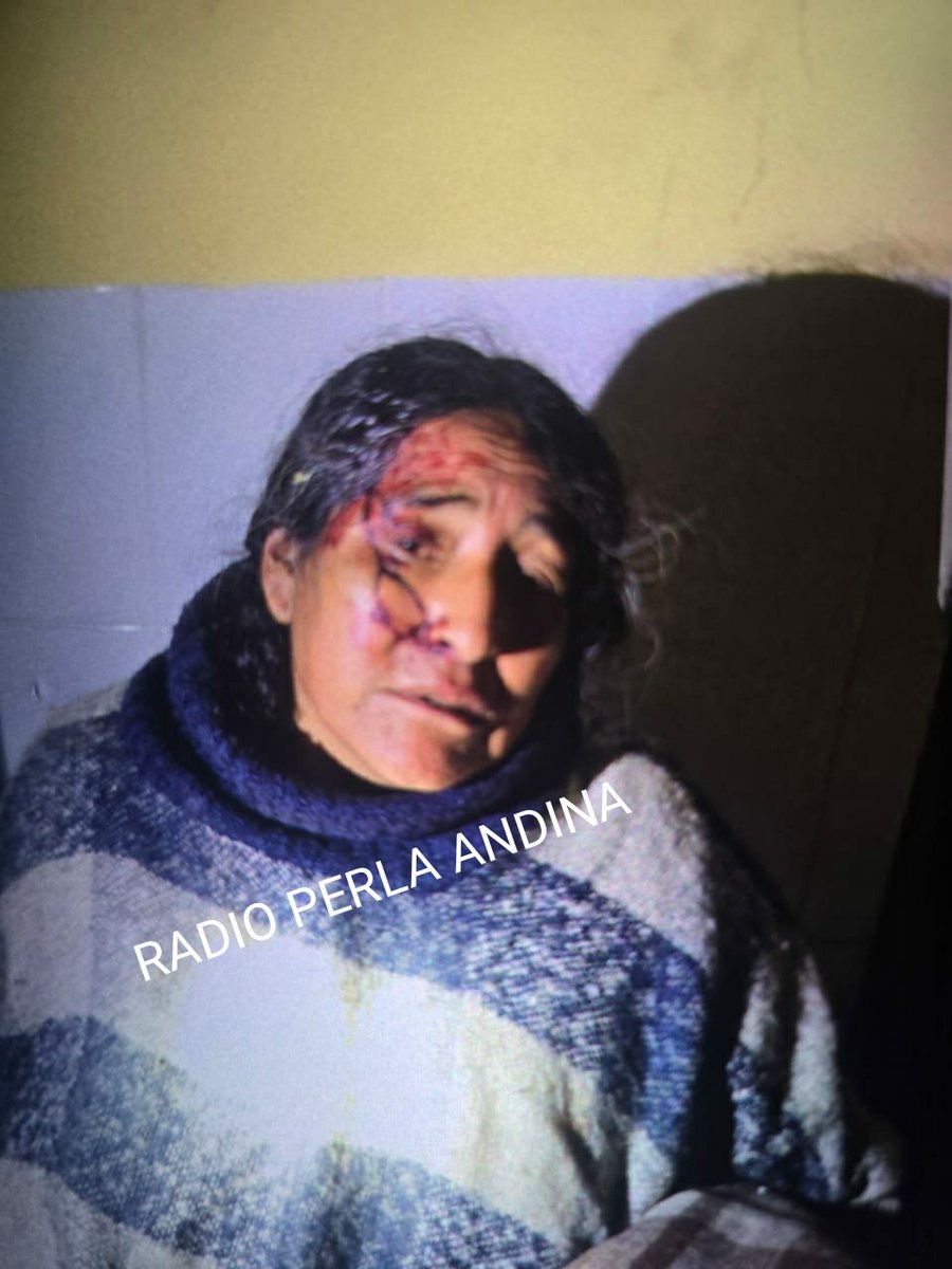 #deÚltimo
Reportan que la madrugada de este jueves hubo #enfrentamiento entre #cooperativas_mineras del #CantónYani en el municipio de #Sorata que dejó varias personas fallecidas y heridas. Las cooperativas mineras enfrentadas pertenecerían a #Señor_de_Mayo e #Hijos_de_Ingenio.