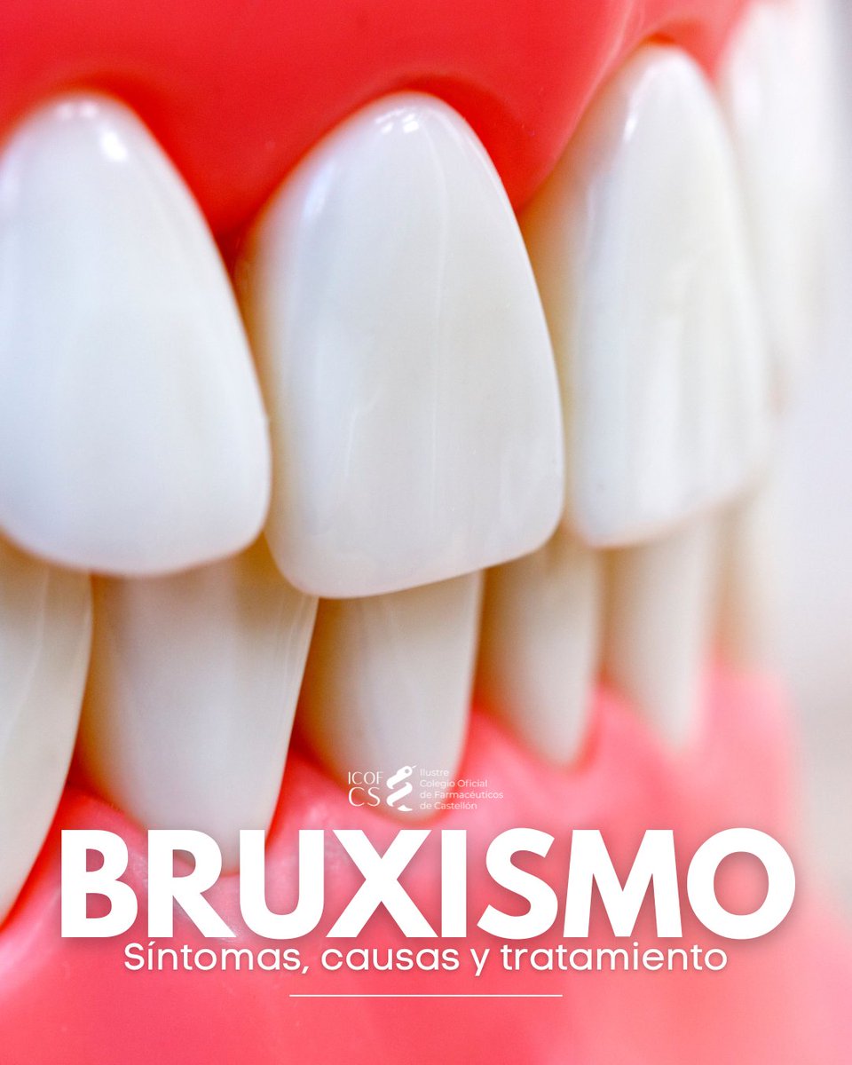 🦷#Bruxismo: Hábito involuntario de apretar/rechinar los dientes.
⚠️Síntoma:
👉🏼Desgaste dental. Dolor/tensión de mandíbula, cabeza o cuello
❌Causa:
👉🏼Estrés. Maloclusión dental. Excesivo de cafeína/alcohol y trastorno del sueño
✅Tratamiento:
👉🏼Uso de férula y relajación
#ICOFCS