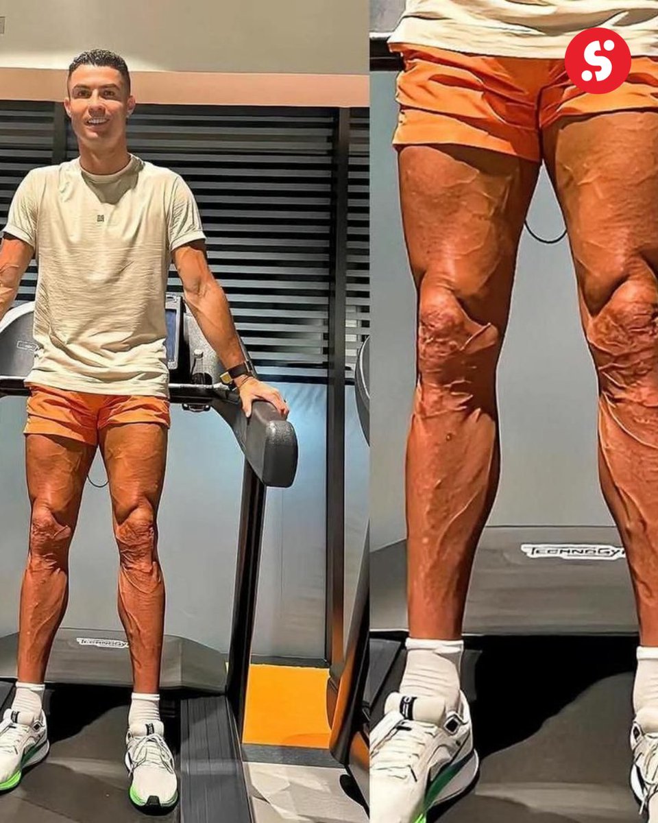 sportybetgh's tweet image. This 70-year-old man is still turning heads—slick and bursting with energy like he's in his prime! Seriously, remind me, how many years did you say you were? 😎🔥
#Ageless #FountainOfYouth #StillGotIt