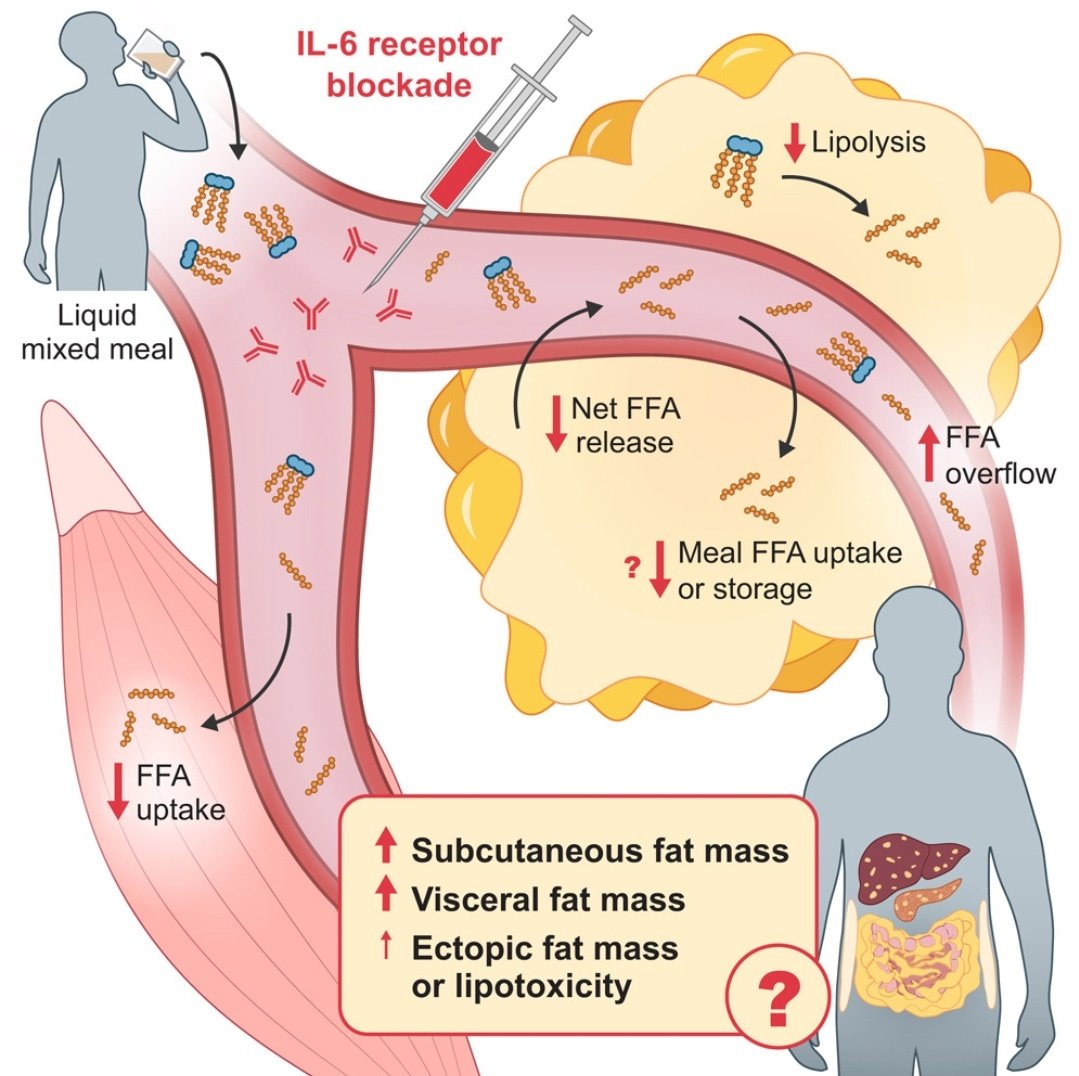 gigo_bufon's tweet photo. Inhibition of basal IL-6 activity promotes subcutaneous fat retention in humans during fasting and postprandial states. https://t.co/OCFIavSxKV
#CardioTwitter #obesity #obesidad #diabetes. https://t.co/x9TpOMhiUU