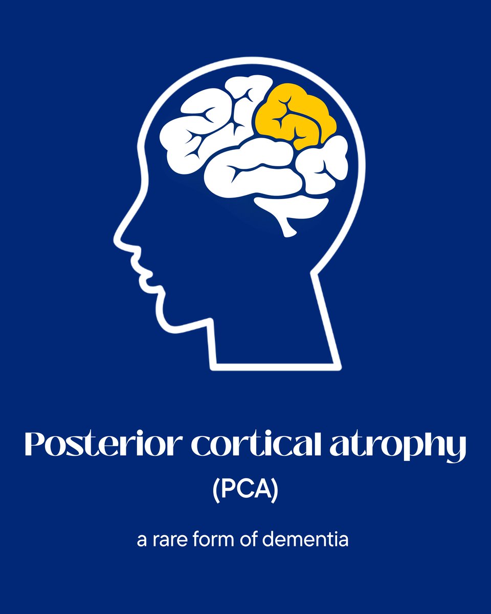 Posterior cortical atrophy (PCA) is a rare form of Alzheimer’s disease that impacts vision at first rather than memory.

Initially, people with PCA tend to have a relatively well-preserved memory but experience problems with their vision, such as difficulty recognising faces and