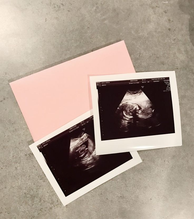 IvankaZogeot's tweet image. ㅤㅤ
         𝐄𝐬𝐭𝐚𝐦𝐨𝐬 𝐟𝐞𝐥𝐢𝐜𝐞𝐬 𝐝𝐞 𝐚𝐧𝐮𝐧𝐜𝐢𝐚𝐫 𝐥𝐚 𝐥𝐥𝐞𝐠𝐚𝐝𝐚 𝐝𝐞
         ❤️🌸Irina Sophie Müller Zograf🎀🩷