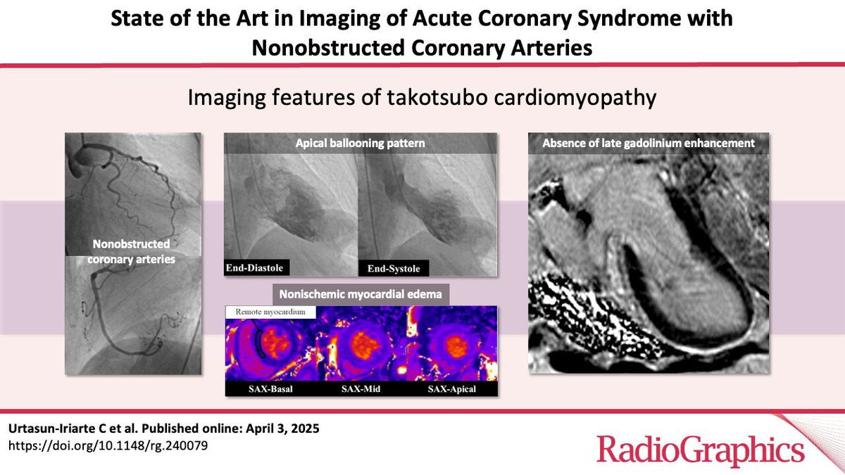 Salvador Pedraza (@salvasapedraza) on Twitter photo State of the Art in Imaging of Acute Coronary Syndrome with Nonobstructed Coronary Arteries | RadioGraphics pubs.rsna.org/doi/10.1148/rg… State of the Art in Imaging of Acute Coronary Syndrome with Nonobstructed Coronary Arteries | RadioGraphics pubs.rsna.org/doi/10.1148/rg…