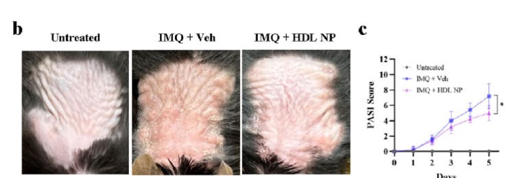 HanPengNU's tweet photo. Our new works at
https://t.co/gwSAdVBgaS. Showing
A novel HDL nanoparticle based lotion is a new targeted therapy for inflammatory skin diseases. https://t.co/WkjIB5GLPC$ https://t.co/TKe6XPgfJO