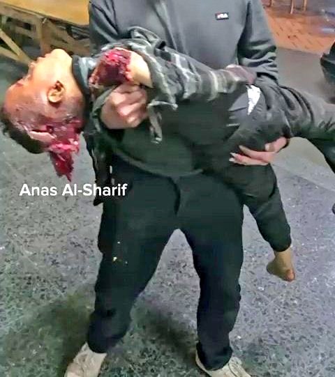 🛑 غزه تنزف اليوم 

#تحديث_بطاقة_ومقاطعة_مليونية