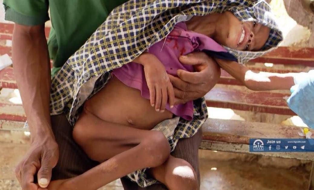 𝓐𝓫𝓮𝓵 (@yi_akl) on Twitter photo No food, no aid, no justice. The people of Tigray continue to endure starvation and suffering. Immediate humanitarian action is needed. <a href="/hammersmithandy/">Andy Slaughter</a> <a href="/KemiBadenoch/">Kemi Badenoch</a> <a href="/johnmcdonnellMP/">John McDonnell</a> <a href="/michelledonelan/">Rt Hon Michelle Donelan</a> <a href="/RichardBurgon/">Richard Burgon MP</a> @Hitentiru #UpholdPretoriaAgreement No food, no aid, no justice. The people of Tigray continue to endure starvation and suffering. Immediate humanitarian action is needed. <a href="/hammersmithandy/">Andy Slaughter</a> <a href="/KemiBadenoch/">Kemi Badenoch</a> <a href="/johnmcdonnellMP/">John McDonnell</a> <a href="/michelledonelan/">Rt Hon Michelle Donelan</a> <a href="/RichardBurgon/">Richard Burgon MP</a> @Hitentiru #UpholdPretoriaAgreement