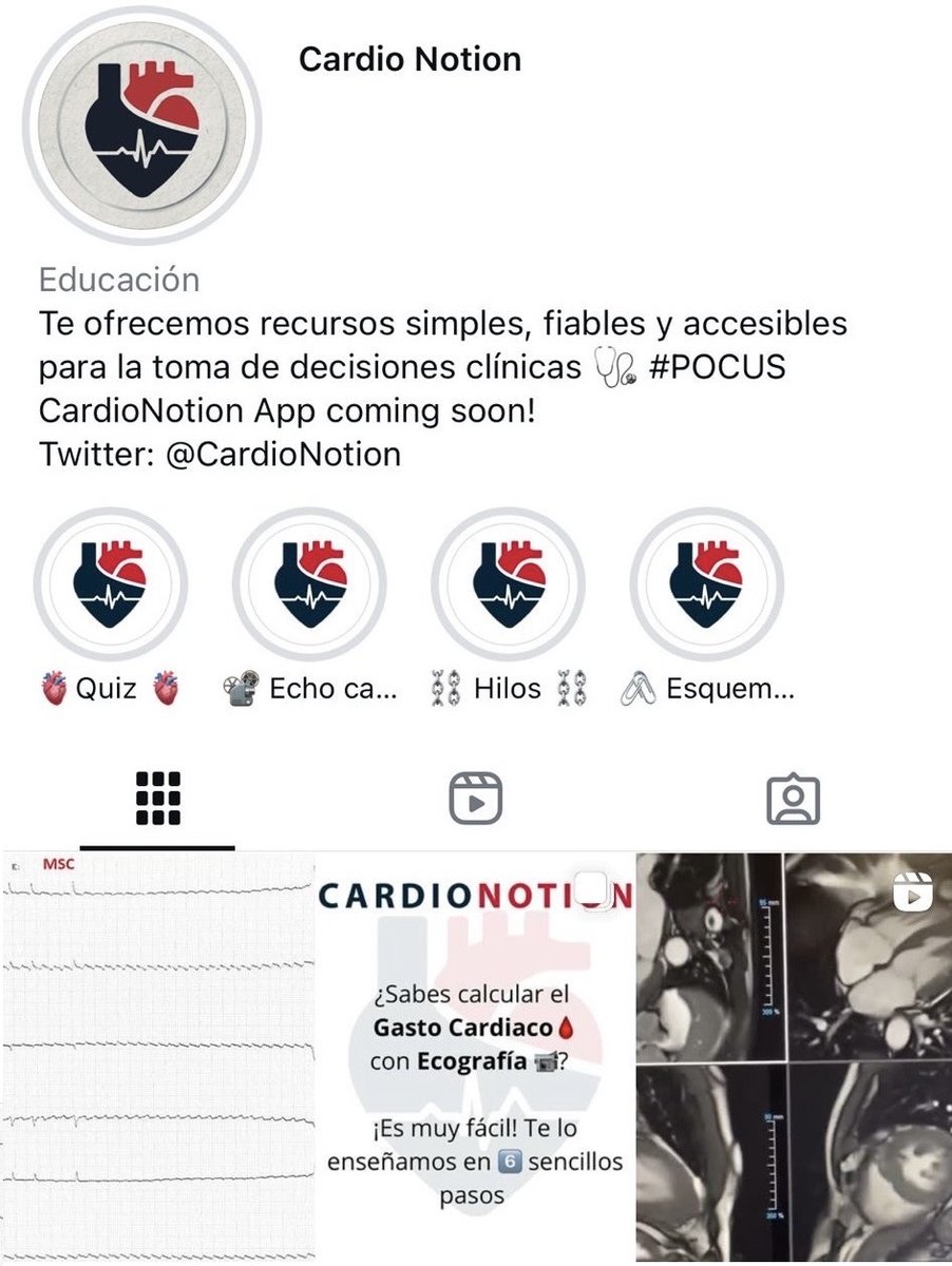 CardioNotion's tweet image. Y hasta aquí el hilo de hoy🧵

Si te ha gustado, no olvides seguirnos en nuestro nuevo lNSTA, donde compartiremos Eco-tutoriales y mucho más.🚀

Te esperamos por allí👇
#CardioNotion