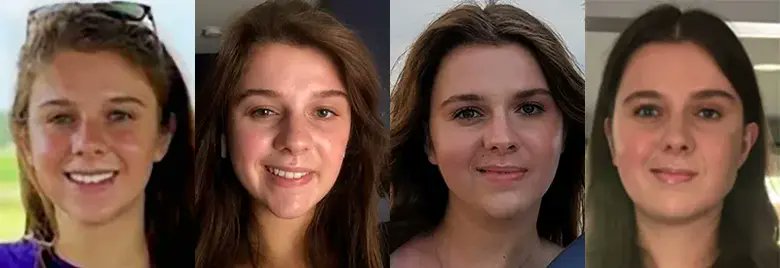 A 13-year-old girl was told she needed immediate surgery to remove a noncancerous facial nerve tumor. This would prevent later complications but also paralyze the left side of her face.

Learn how a novel approach helped preserve her smile: cle.clinic/3E4Y1XM