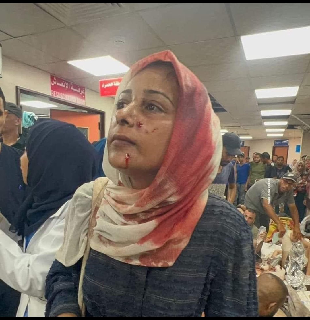 "Eşim gözlerimin önünde şehit oldu. Yetim oğlumun bacağı koptu. Başörtüm ile bacağını bağlayıp 4 km taşıdım. Oğlum da şehit oldu. Elimden bu geliyordu bunu yaptım. Başörtüm bile işe yaradı ama Müslümanlar başımdaki kanlı örtüm kadar fayda vermedi bize"
Ümmü Rezzan
#NoFlourinGaza