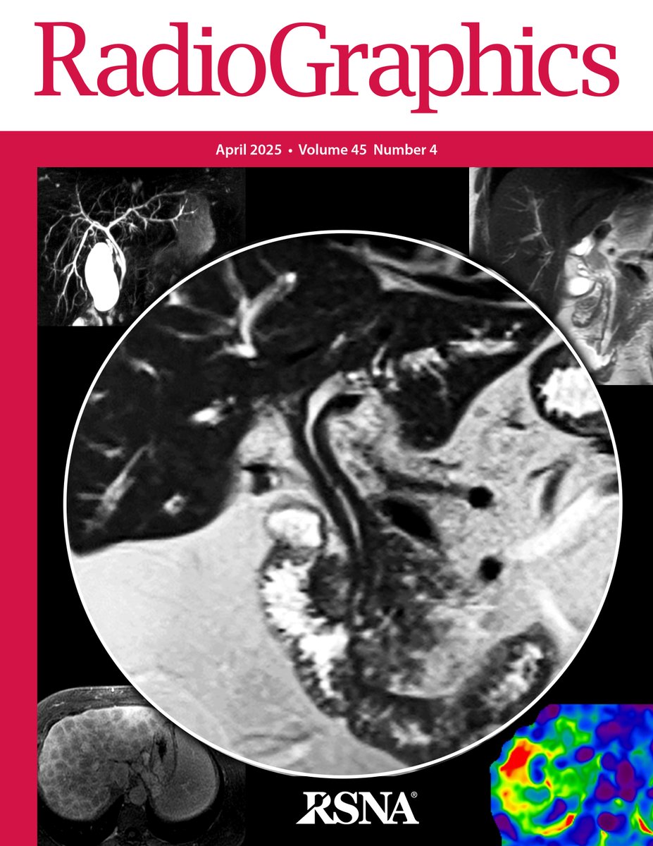 RSNA's tweet photo. The latest issue of @RadioGraphics is now available! Check out the April issue here. https://t.co/L09FUJ8E49 #RGphx #RadCME #RadRes https://t.co/6xy0OztKV5