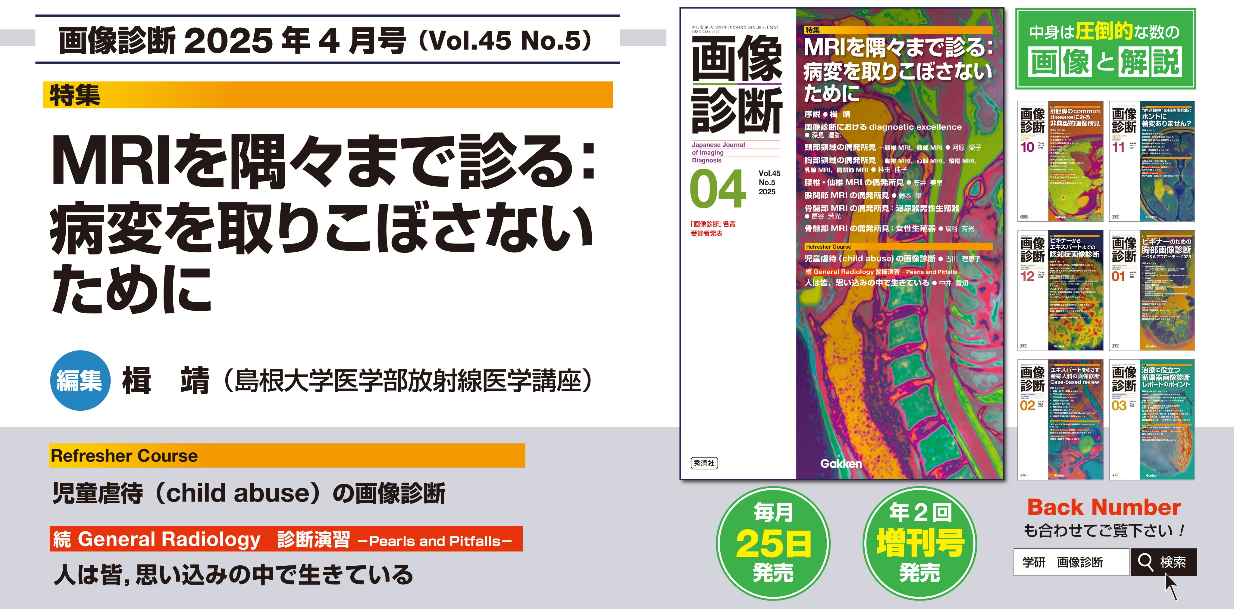 Gakken 月刊『画像診断』 (@gazou_shindan) / X Gakken 月刊『画像診断』 (@gazou_shindan) / X