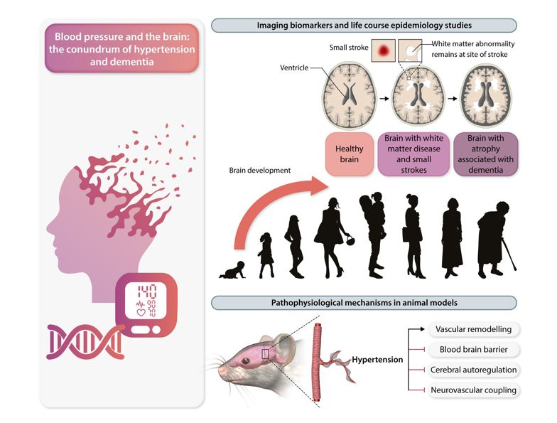 European Society of Cardiology Journals (@esc_journals) on Twitter photo The conundrum of hypertension & #dementia 🧠
This must-read #CardiovascularResearch Spotlight Review explores the link between #hypertension & brain health, including mechanisms & treatment
academic.oup.com/cardiovascres/…
<a href="/CVR_TomaszGuzik/">CVR Tomasz Guzik</a> <a href="/Sarah_KBrown/">Sarah Brown</a> <a href="/glenpyle/">Glen Pyle | #WomensHeartHealth ❤️🩹🖇️</a> <a href="/DrMikeDrozd/">Mike Drozd</a> #stroke The conundrum of hypertension & #dementia 🧠
This must-read #CardiovascularResearch Spotlight Review explores the link between #hypertension & brain health, including mechanisms & treatment
academic.oup.com/cardiovascres/…
<a href="/CVR_TomaszGuzik/">CVR Tomasz Guzik</a> <a href="/Sarah_KBrown/">Sarah Brown</a> <a href="/glenpyle/">Glen Pyle | #WomensHeartHealth ❤️🩹🖇️</a> <a href="/DrMikeDrozd/">Mike Drozd</a> #stroke