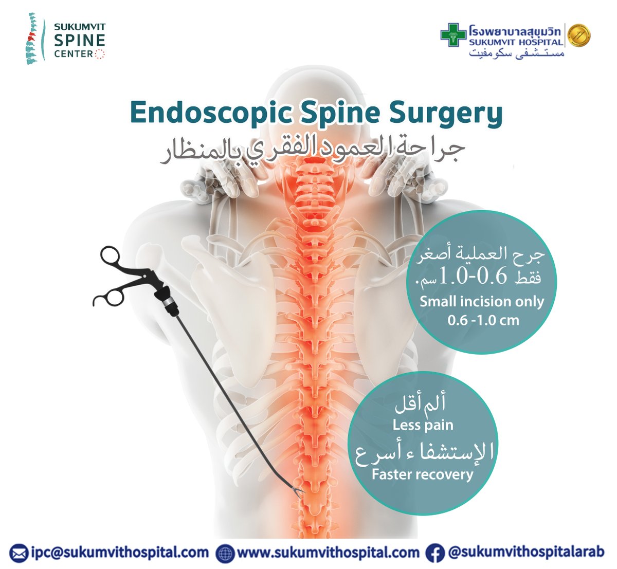 📍جراحة العمود الفقري بالمنظار
أحدث التقنيات لعالج آالم الظهر
🔸دقّة
🔸انخفاض خطر اإلصابة بالعدوى
🔸التعافي السريع
🔸جرح شق صغير فقط 6.0-0.1 سم
#SukumvitHospital