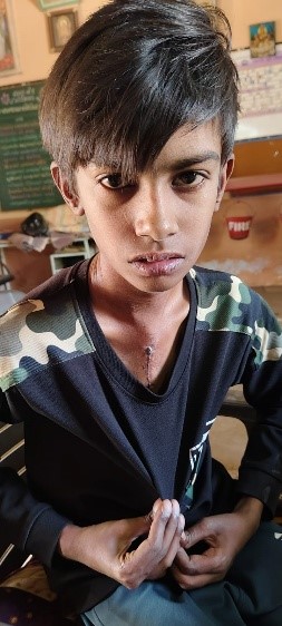 CollectorRjt's tweet image. ધોરાજી તાલુકાના મોટીમારડ ગામમાં ખેત મજૂરી કરતા પરિવારના ધાર્મિક લોડારિયાની રાષ્ટ્રીય બાળ સ્વાસ્થ્ય કાર્યક્રમ અંતર્ગત યુ એન મહેતા હોસ્પિટલમાં વિનામૂલ્યે હૃદયની સર્જરી કરતા  મળ્યુ નવ જીવન.