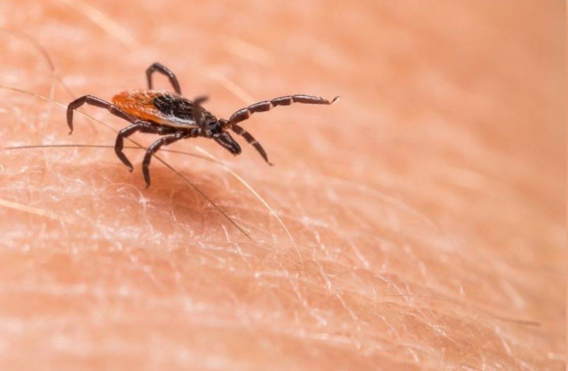 ERINHA (@erinha_ri) on Twitter photo An 18-year-old has died of Crimean-Congo Hemorrhagic Fever #CCHF in Quetta. Another case brings the province’s total to 41. Health officials urge strict precautions as the tick-borne virus continues to pose a serious threat.
nation.com.pk/02-Apr-2025/fi… An 18-year-old has died of Crimean-Congo Hemorrhagic Fever #CCHF in Quetta. Another case brings the province’s total to 41. Health officials urge strict precautions as the tick-borne virus continues to pose a serious threat.
nation.com.pk/02-Apr-2025/fi…