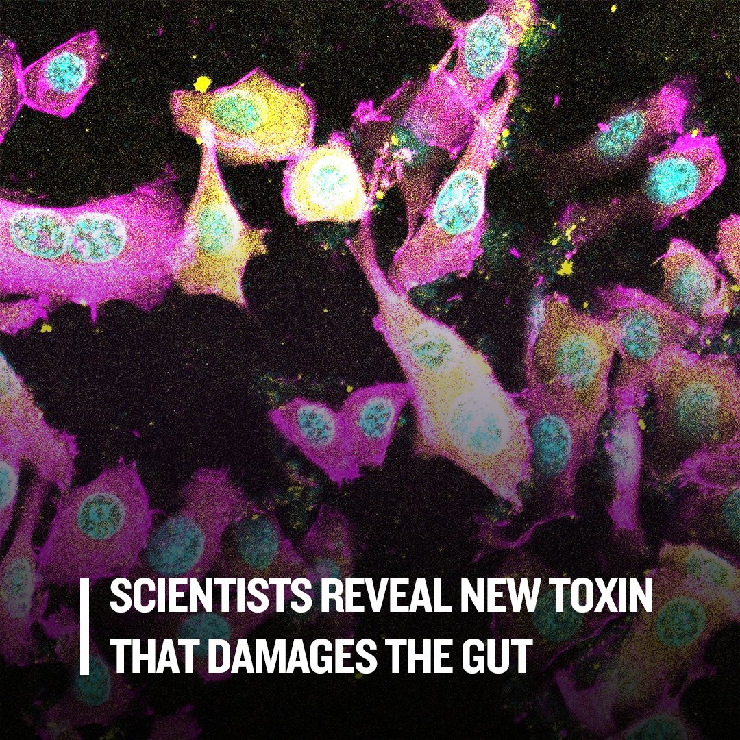 🦠 New research in Gut Microbes led by LIMS &amp; @SABE_Latrobe’s Prof Begoña Heras, Dr Jason Paxman &amp; Dr Akila Pilapitiya show how E. coli (EPEC type) uses toxic “molecular scissors” to destroy gut cells, leading to illness and sometimes death. Read 👉 latrobe.edu.au/news/articles/…