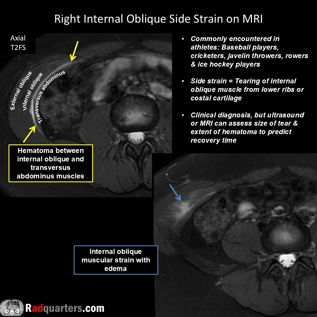 Radquarters's tweet image. #FOAMrad #FOAMed #mskrad #radres #radtech #medstudent #radquarters