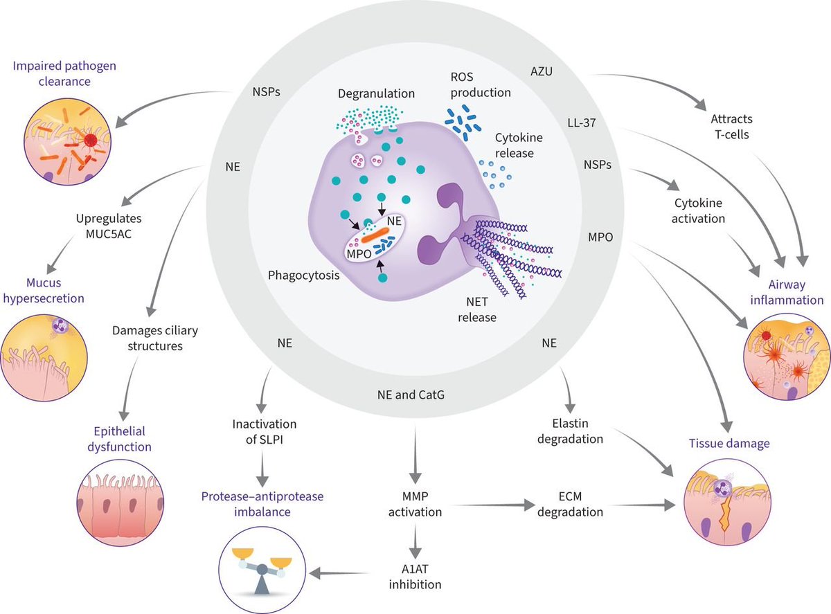 James D Chalmers (@profjdchalmers) on Twitter photo Just published online at <a href="/ERSpublications/">ERS publications</a> ERR
A deep dive into neutrophils and their role in bronchiectasis
An exciting new era with therapies targeting this treatable trait Just published online at <a href="/ERSpublications/">ERS publications</a> ERR
A deep dive into neutrophils and their role in bronchiectasis
An exciting new era with therapies targeting this treatable trait