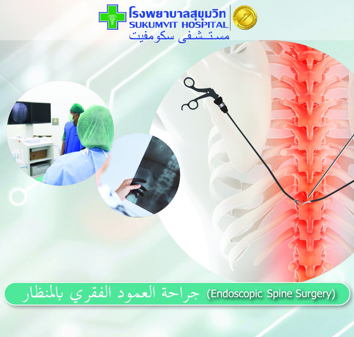 مركز العمود الفقري ، مستشفى سوكومفيت ، بانكوك ، تايلاند يشتهر مركز العمود الفقري لدينا بفريق الأطباء المتمرسين الذين أكملوا التخصصات الفرعية. يقدم مركز العمود الفقري لدينا علاجًا لأمراض العمود الفقري من خلال أخصائي متخصص في العمود الفقري. #SukumvitHospital #Bangkok #Thailand #JCI