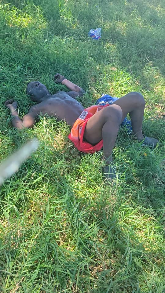 This man tempered with cables at the Barnsley Zesa substation. He's badly burnt and currently awaiting an ambulance at the corner Glencoe and Chiremba