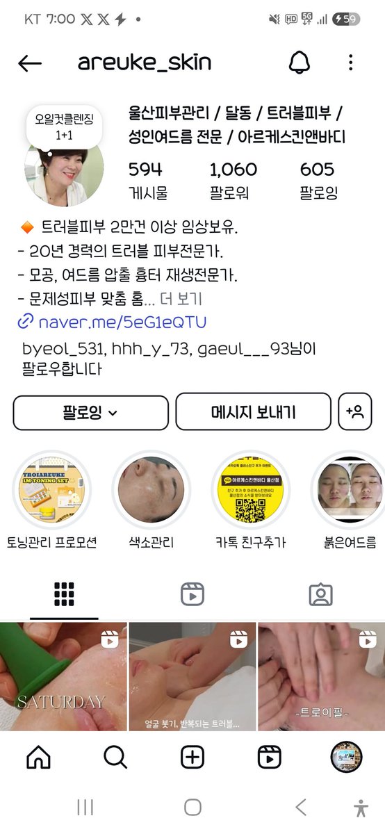 안녕하세요! 올릴지 말지 고민하다 어머니가 너무 힘들어하셔서 용기내어 홍보글 올려봅니다!
어머니는 울산에서 15년 넘게 피부관리샵을 꾸준히 운영하셨는데 특히 여드름 피부 척척박사십니다! 저도 여드름 진짜 심했는데 어머니가 갱생해주셨어요...
>>@areuke_skin
