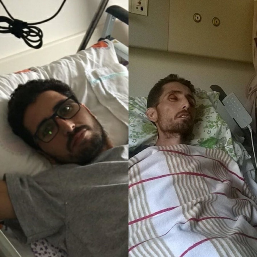 KHK’lı Polis Kadir Eyce, bankaya para yatırdığı gerekçesiyle tutuklandı. Sivas E Tipi Cezaevi’nde kansere yakalandı. Hastalığının ilerlemesine seyirci kalındı. Tahliye edildiğinde artık çok geçti.
11 Nisan 2017’de 33 yaşında hayata veda etti.