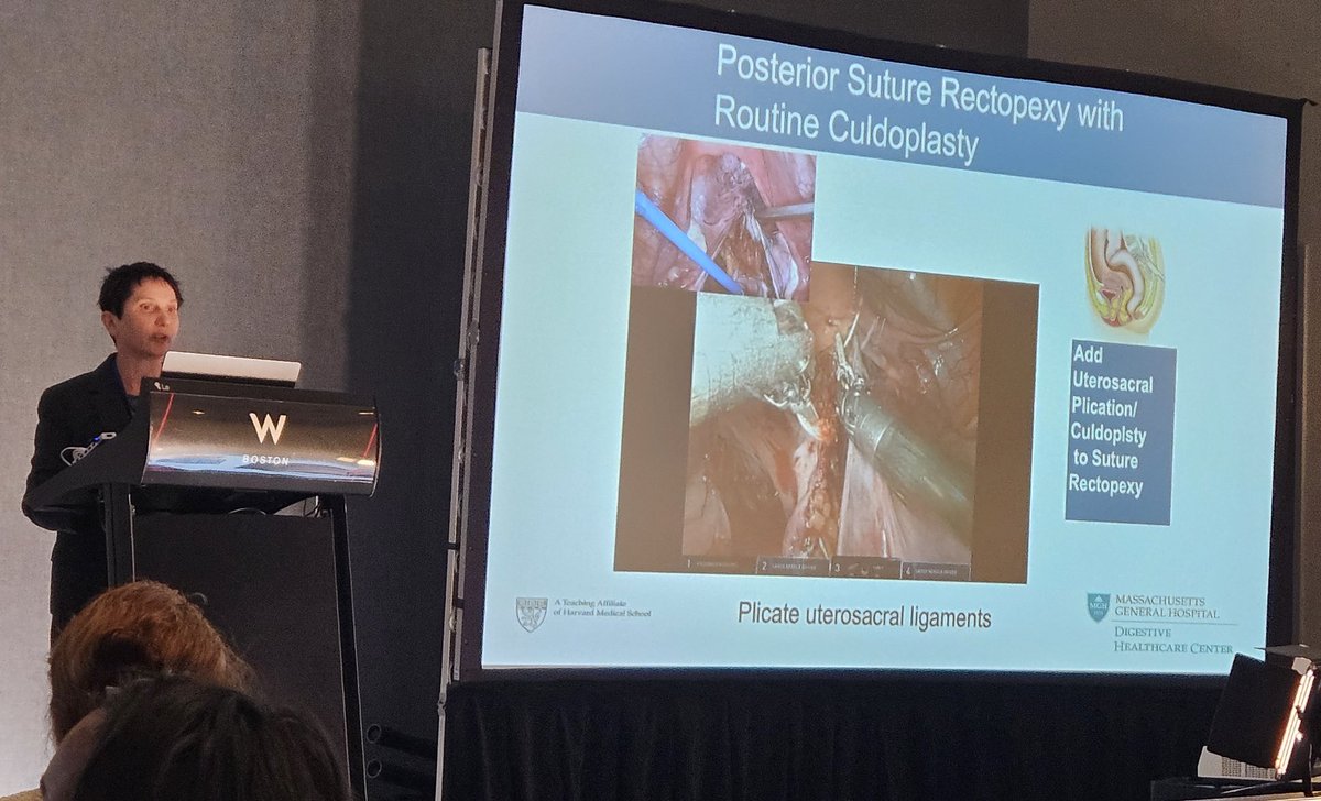 ISUCRS (@isucrs1) on Twitter photo Multidisciplinary treatment of
Rectal Prolapse. Dr. <a href="/LilianaBordei/">Liliana Bordeianou, MD, FACS, FASCRS</a> at Advances and Controversies in Benign Colorectal Surgery in Boston.
<a href="/harvardmed/">Harvard Medical School</a> <a href="/ISUCRS1/">ISUCRS</a> Multidisciplinary treatment of
Rectal Prolapse. Dr. <a href="/LilianaBordei/">Liliana Bordeianou, MD, FACS, FASCRS</a> at Advances and Controversies in Benign Colorectal Surgery in Boston.
<a href="/harvardmed/">Harvard Medical School</a> <a href="/ISUCRS1/">ISUCRS</a>