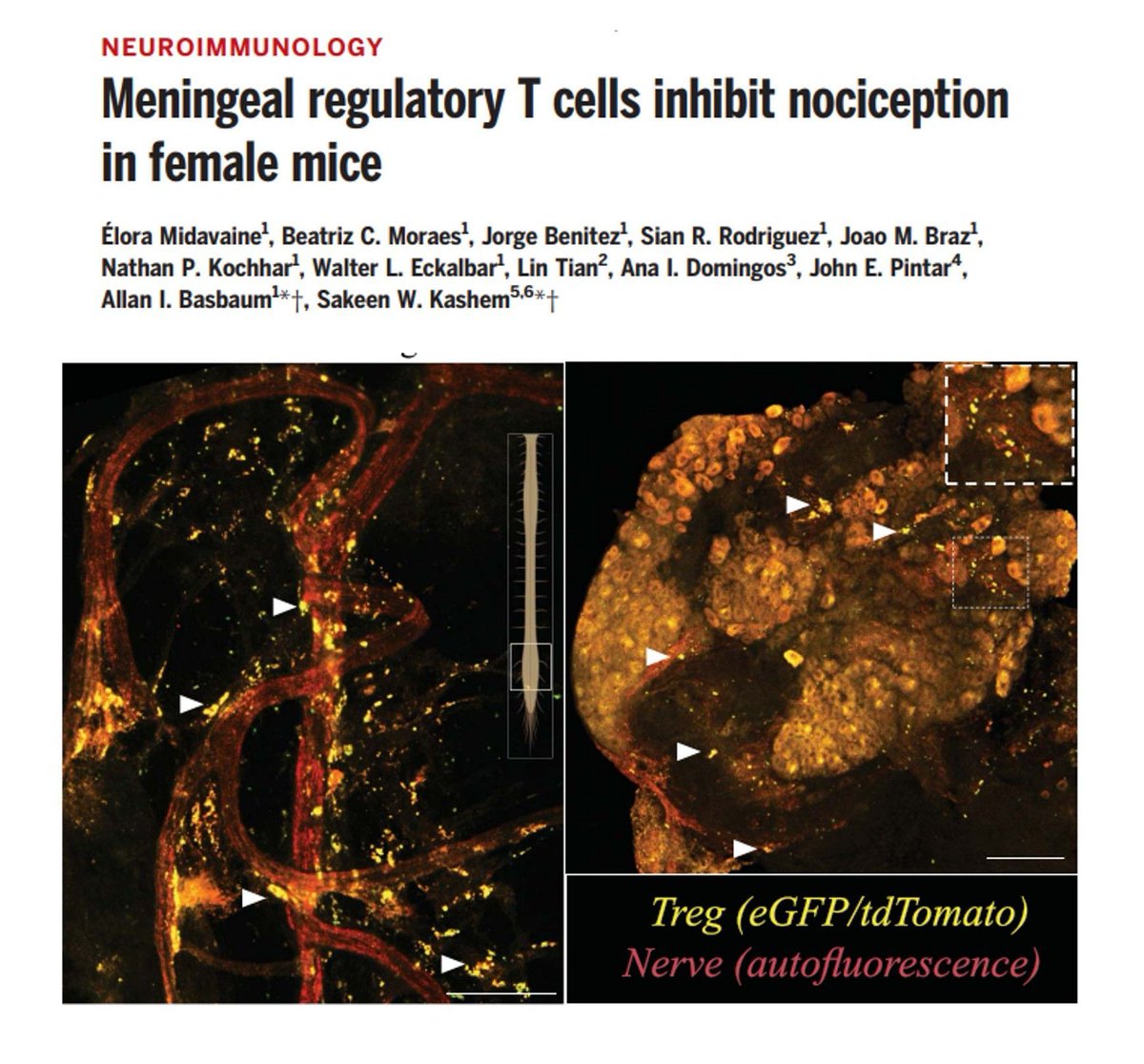 Sarah Ross (@sarah_h_ross) on Twitter photo #Immunology out now <a href="/ScienceMagazine/">Science Magazine</a>
Regulatory T cells inhibit pain sensing in female, but not male, mice.
buff.ly/GU13Wsz
By <a href="/EloraMidavaine/">Élora Midavaine</a>, <a href="/sakeen_k/">Sakeen Kashem</a> et al. #Immunology out now <a href="/ScienceMagazine/">Science Magazine</a>
Regulatory T cells inhibit pain sensing in female, but not male, mice.
buff.ly/GU13Wsz
By <a href="/EloraMidavaine/">Élora Midavaine</a>, <a href="/sakeen_k/">Sakeen Kashem</a> et al.