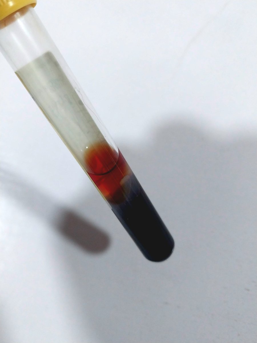 Hello, Med Lab scientists!

When you run a test and get an abnormal or out of range result, what do you do?

You begin to consider some factors, check history, sample, your QC, your equipment, test process, etc, and even rerun... your mind no go touch ground abi? 😂

But