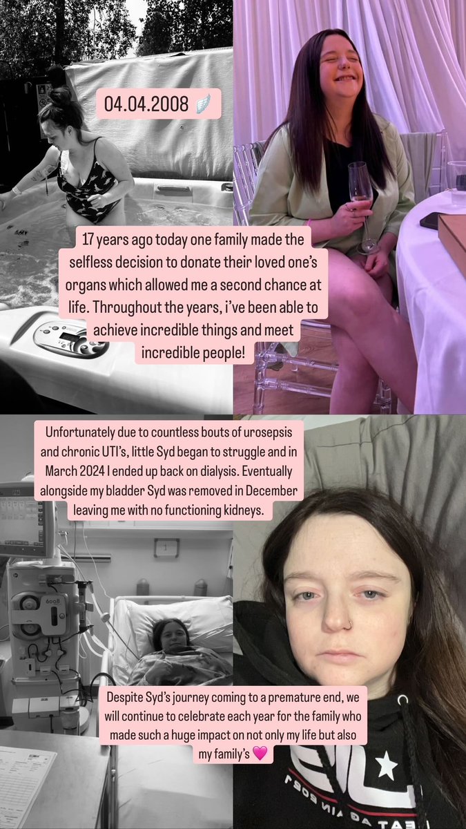 04.04.2008 🪽 

17 years ago today one family made the selfless decision to donate their loved one’s organs allowing me a second chance at life. 
Unfortunately, Syds journey came to a premature end in March 24’ and i’m currently awaiting a second transplant🩷

<a href="/NHSOrganDonor/">NHS Organ Donation 💗🫀🫁</a>